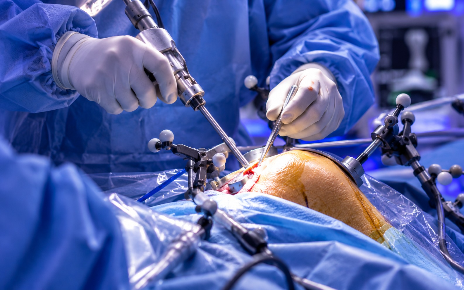 Surgeon-led procedure